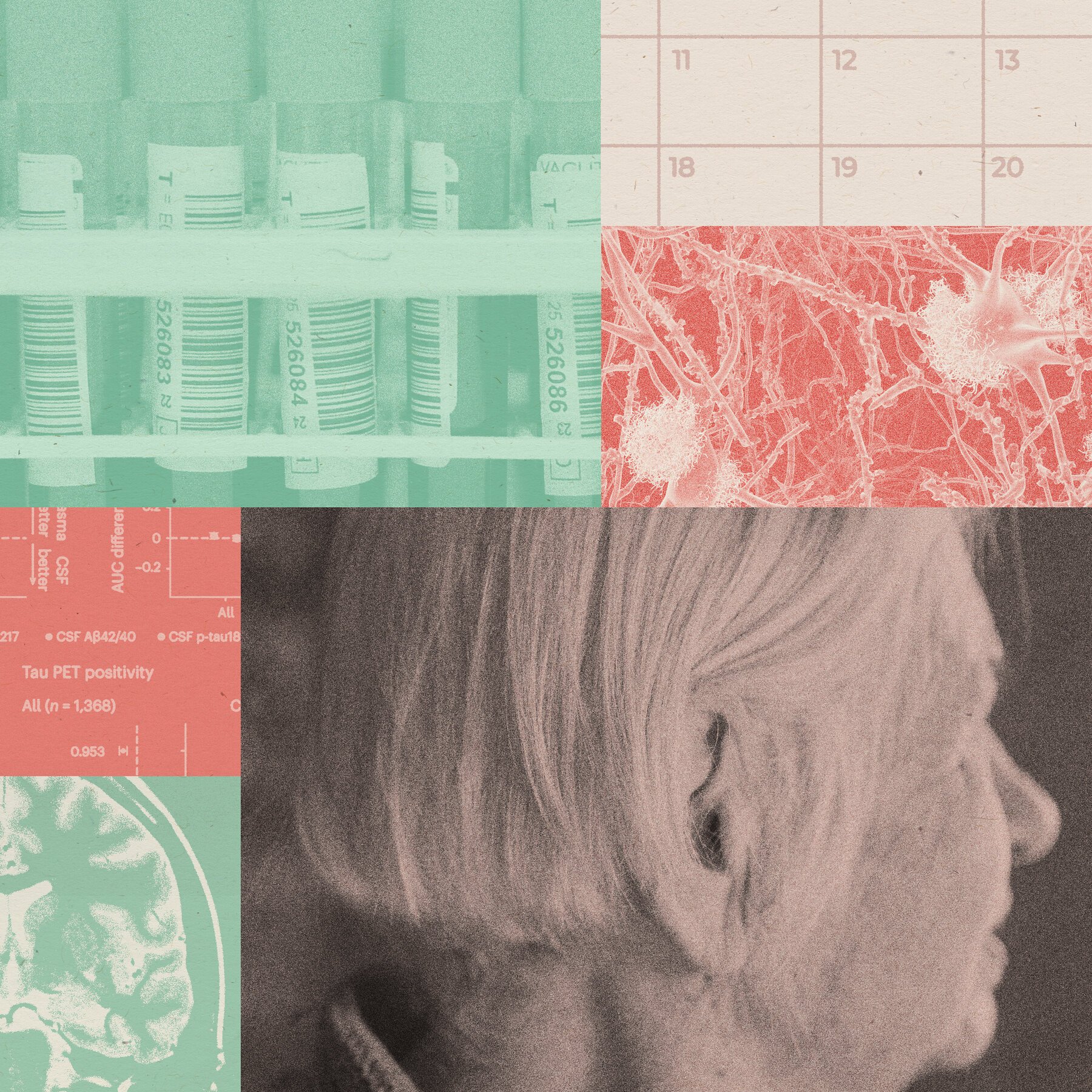featured Alzheimers Blo
